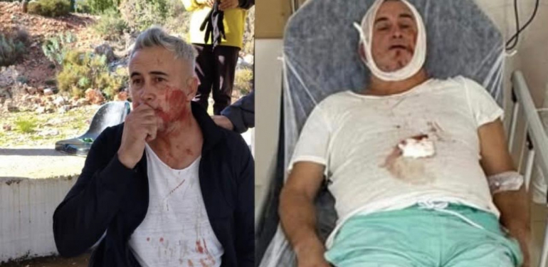 U14 maçı sonrası şiddet iddiası: Veli hastanede – Birlik Haber Ajansı